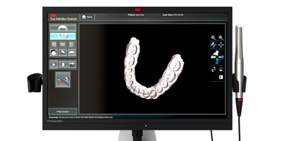 3M™ True Definition Scanner

